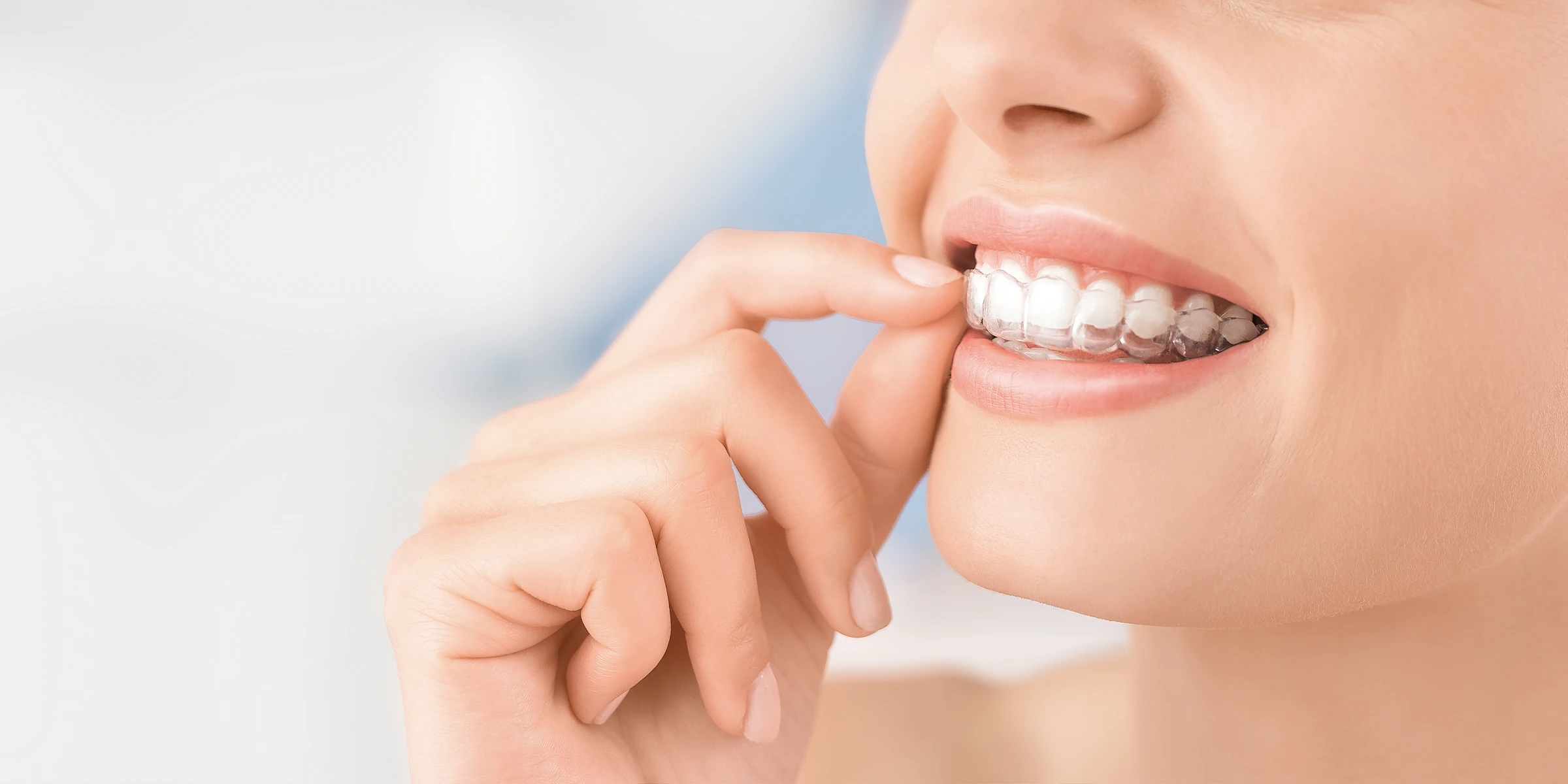 aligner
